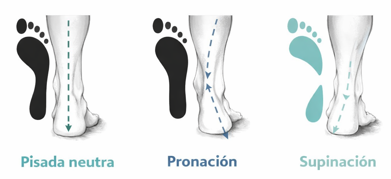 tipos de pisada neutra pronación y supinación explicación biomecánica